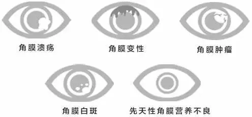 9aa73ea13cfb0c7e38bf9dba67e9f7b.png