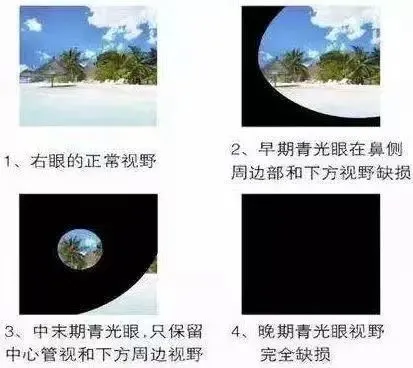 ea60f253b3750cbe0bcddf30d88dc24.png