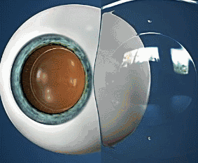 3.gif