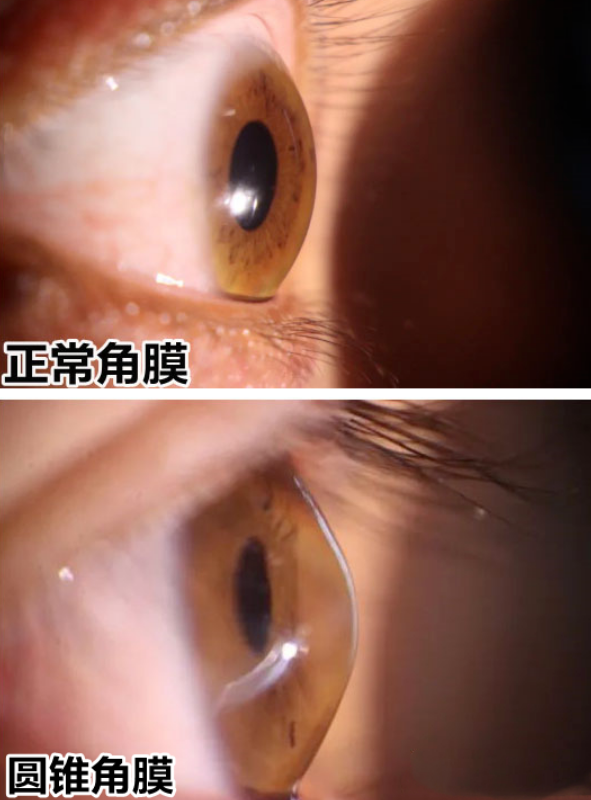 ca8796fb2dcca3866f7547893509f60.png