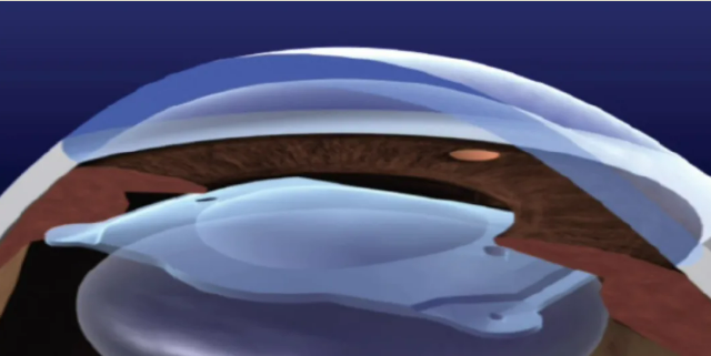 911642715ee3bc6aea9349eb845d699.png