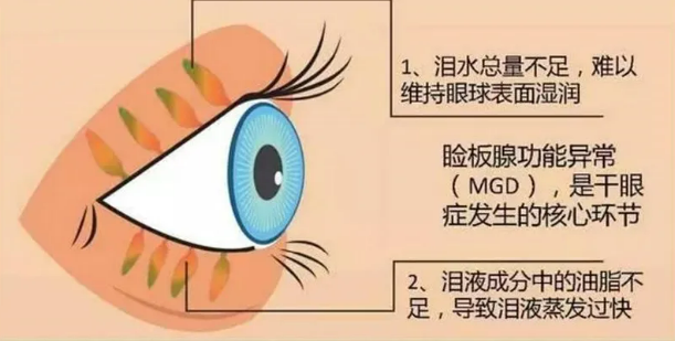 e5998698122e99e636bd6880951a4f2.png