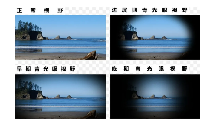 a472a87c8ec3a3e972cedce1bf7cc99.png