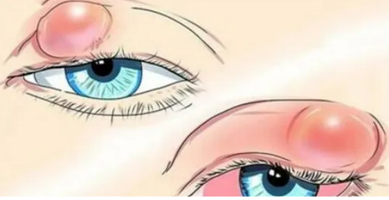 e25878dfd384713c6aa7148d939e16f.png
