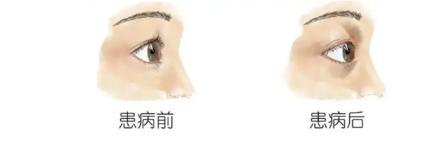 debe20c883a51e49114a2b1be18e321.png