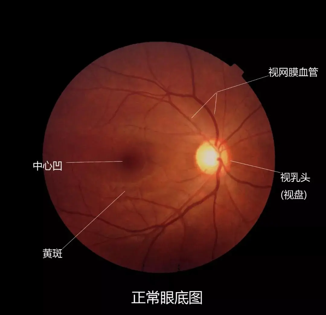 图片87.png