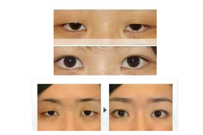 1752135445319422.png 6ca6581a03660a8ff1cbdd69c54cc1f.png