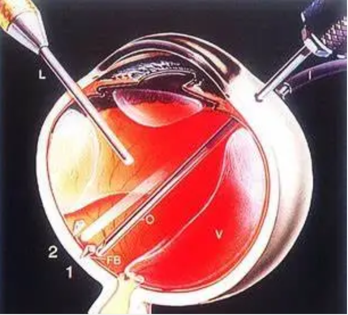 1752648510722116.png image.png