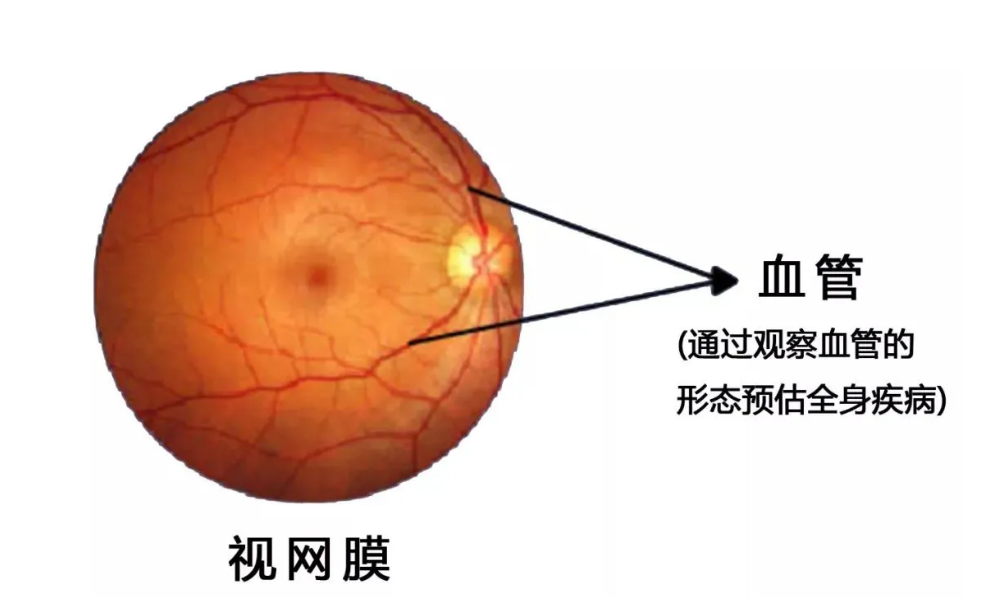 c6023ac5534efb575dcb8238b99497d.png