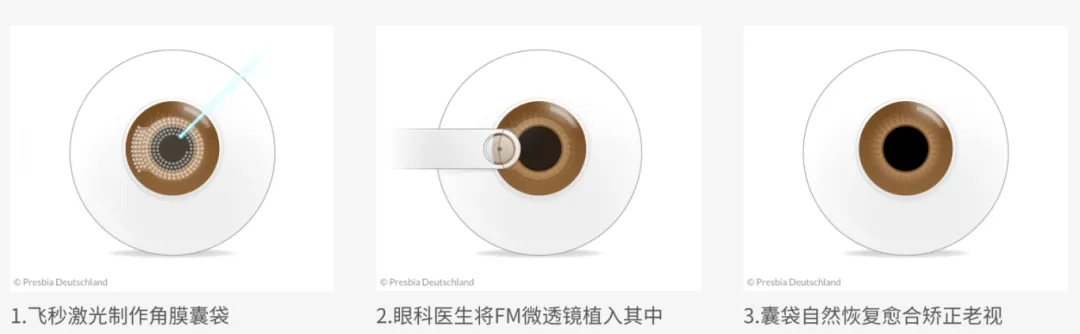 d404f67ef513c974d488e6f406d3e5af.png