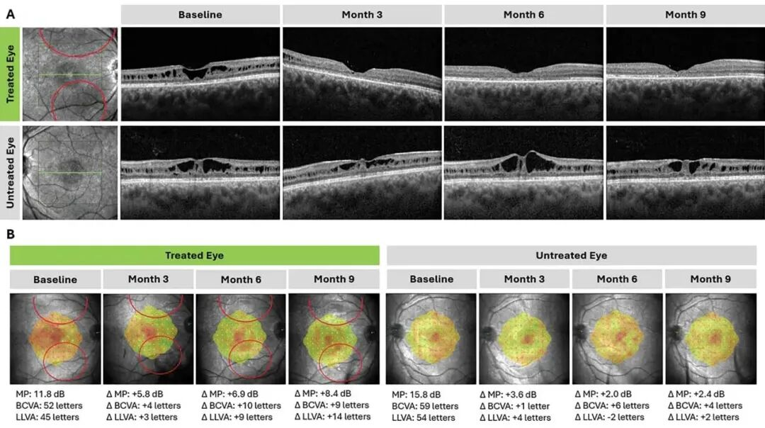 1763459760995554.png 1763459760995554.png