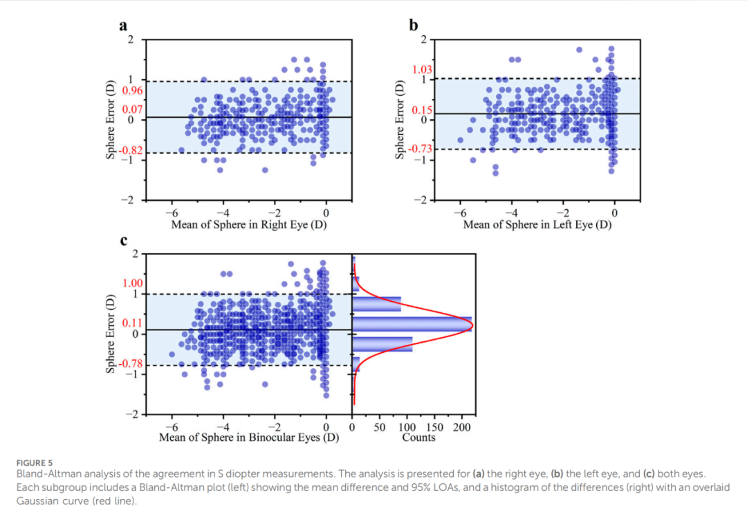 天津医科大学眼科医院视光团队突破性成果：基于智能手机实现居家全参数近视筛查