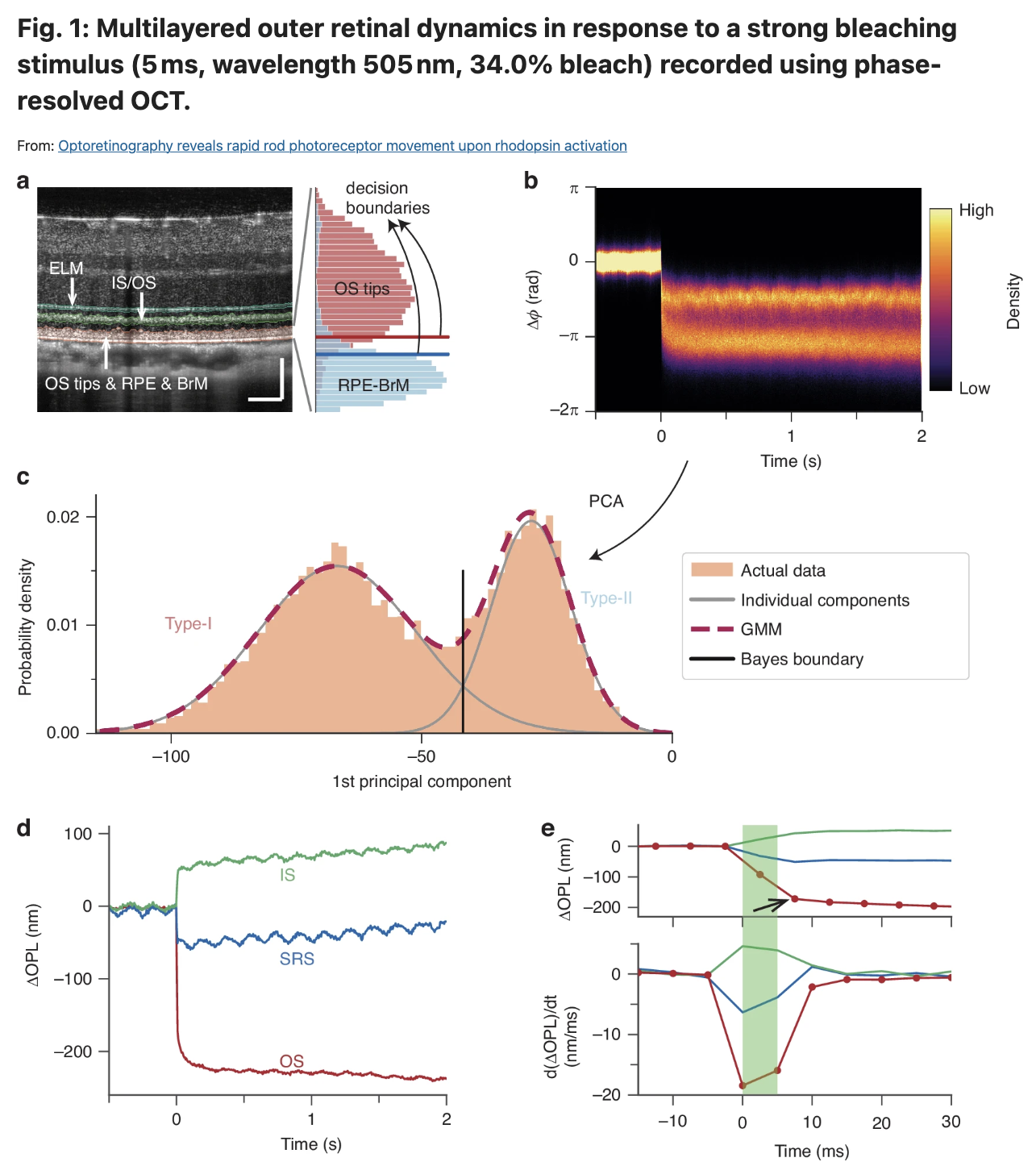 新型视网膜成像技术实现活体视杆细胞功能直接测量