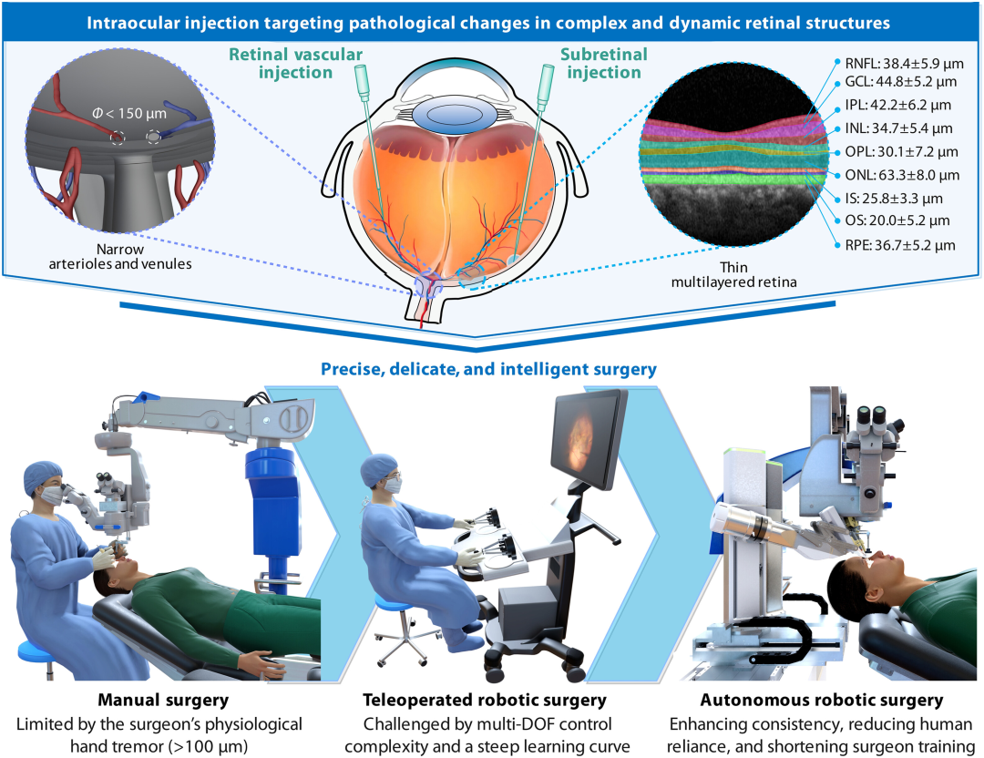 全球首个机器人实现全自主视网膜靶向注射