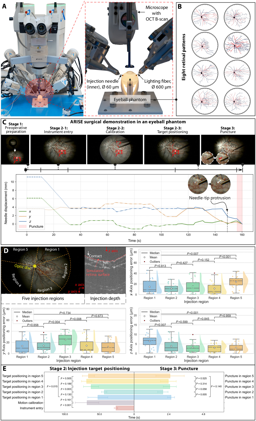 球首个机器人实现全自主视网膜靶向注射