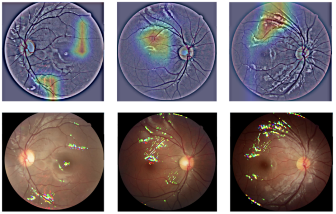 JAMA子刊儿童近视预测新突破